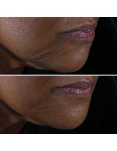 CLINIQUE SMART CLINICAL REPAIR...