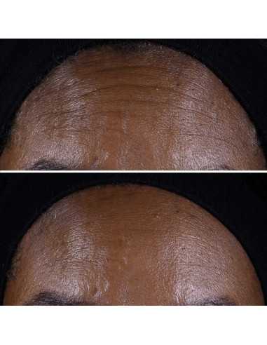 CLINIQUE SMART CLINICAL REPAIR...