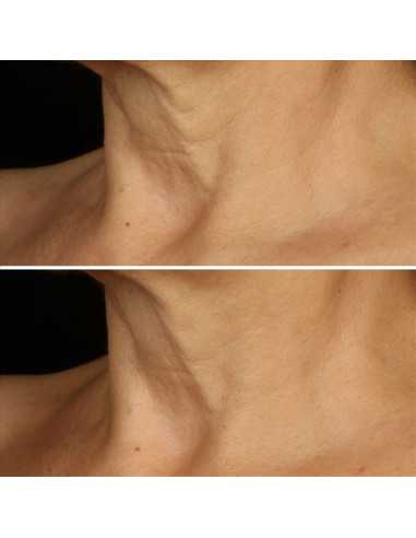 CLINIQUE SMART CLINICAL REPAIR...